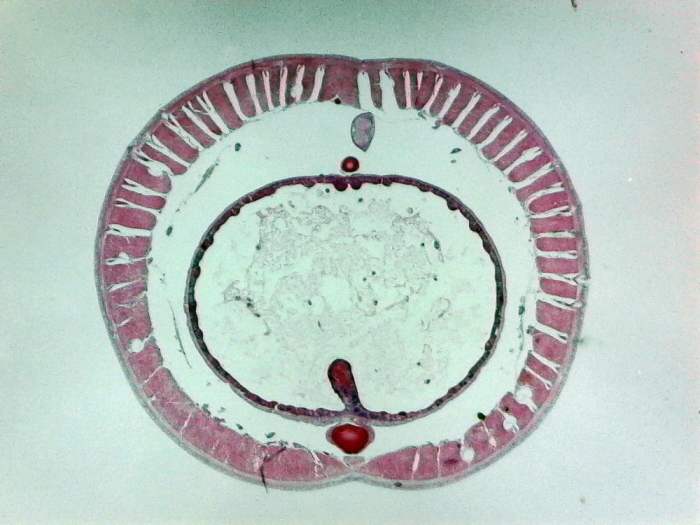 Section cross earthworm microscope slide prepared posterior enlarge click